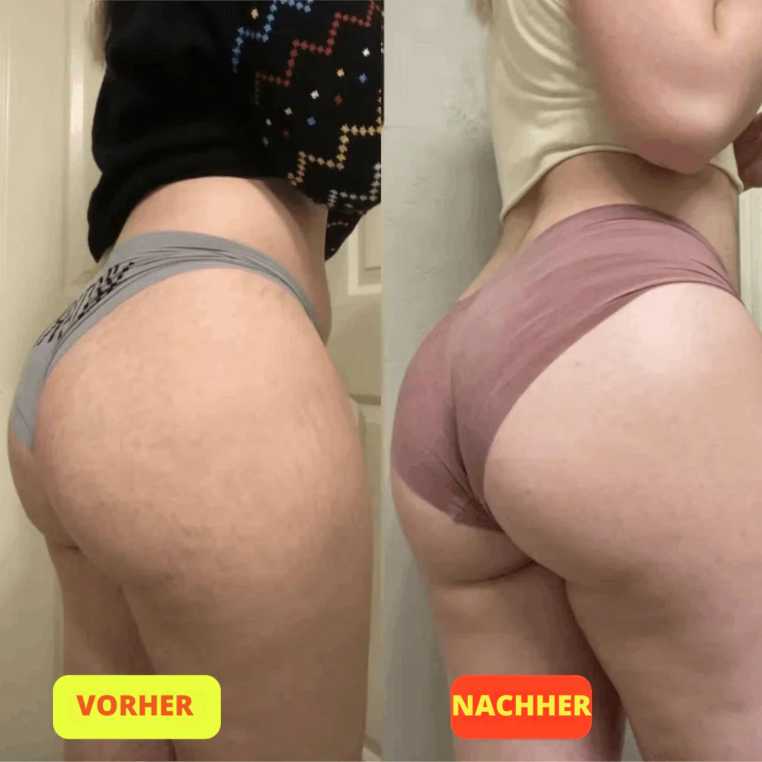 GlutePro™ Max – Booty Trainer für Straffere & Stärkere Gesäßmuskeln