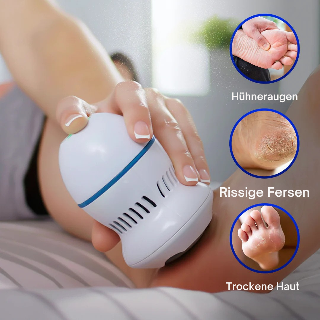 Pedismooth™ | Hornhautentferner für die Füße